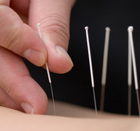 ¿Qué es la Acupuntura?
