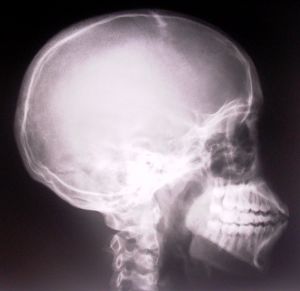 El uso de Imanes en la Medicina no es una Idea Nueva!