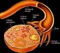 Cáncer de ovario